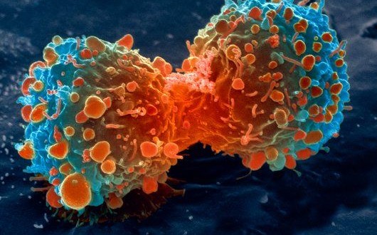 Tế bào ung thư tự tiêu huỷ bởi nước cây sả tươi