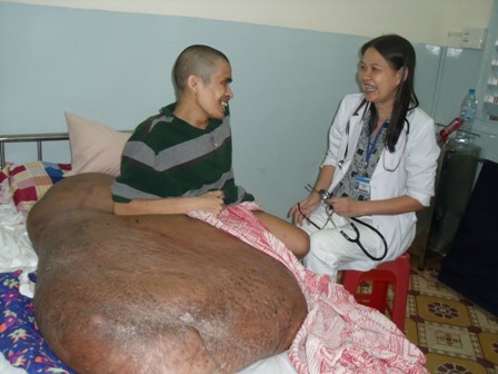chua the giai thoat cho benh nhan mang khoi u 80kg